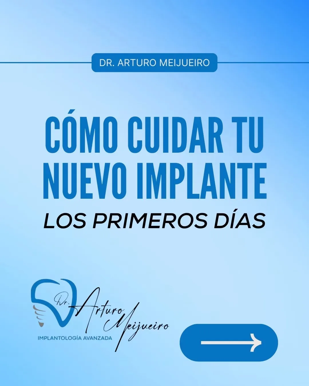 Guía de cuidados de implantes dentales